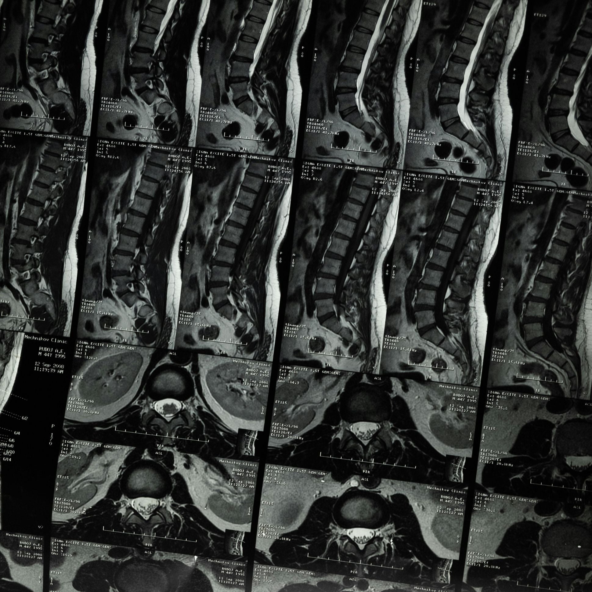 Grid of medical scans showing spinal and pelvic structures.